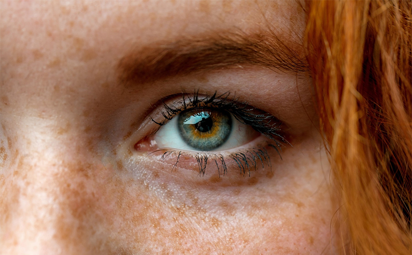 Close-up of a woman's freckled eyes, highlighting their unique patterns and colors
